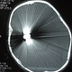 Image for article titled This is what happens when you try to scan a brain with a bullet in it